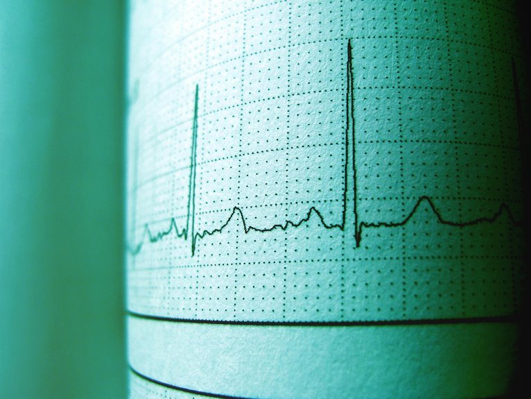 call retry frequency monitoring